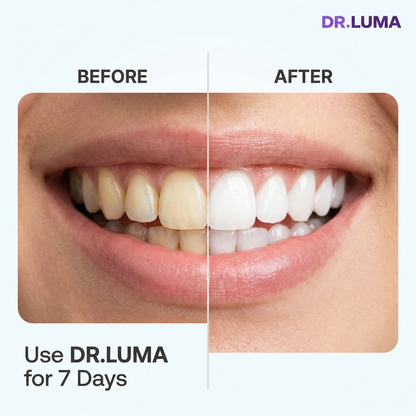 Purple Teeth Whitening Strips